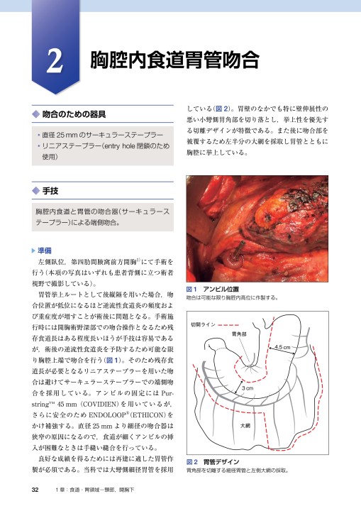 消化管吻合法バイブル [Web動画付] 消化管吻合法バイブル［Web動画付］理学』 立ち読み