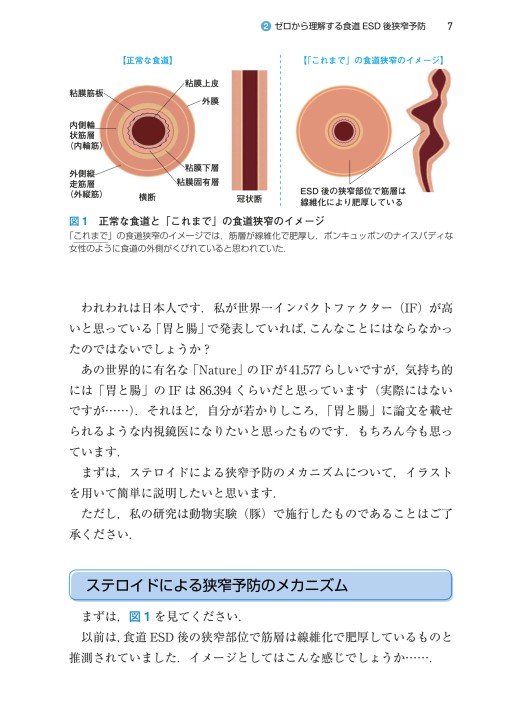 上部・下部消化管 内視鏡診断マル秘ノート2_立ち読み