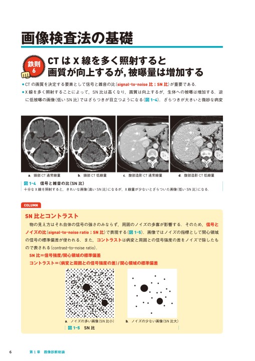 レジデントのための画像診断の鉄則』 立ち読み