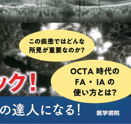蛍光眼底造影ケーススタディ エキスパートはFA・IA・OCTAをこう  