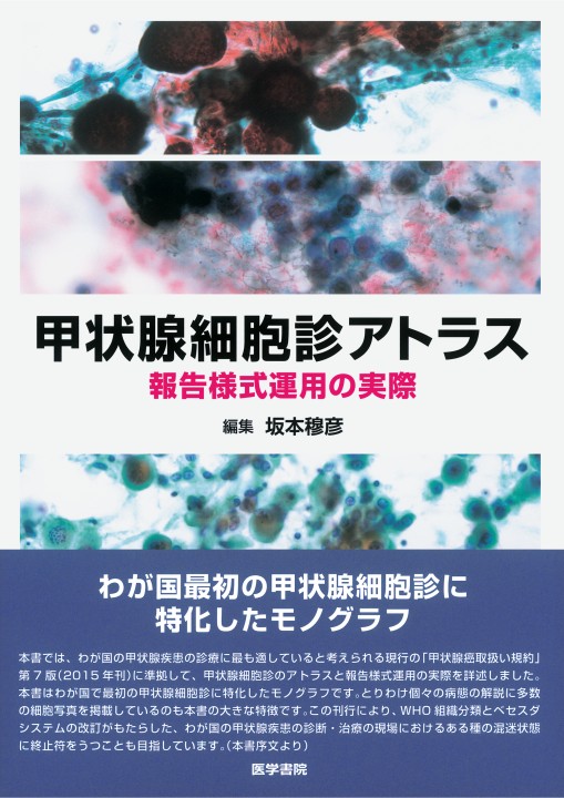 甲状腺細胞診アトラス 報告様式運用の実際 立ち読み 甲状腺細胞診アトラス 報告様式運用の実際 立ち読み