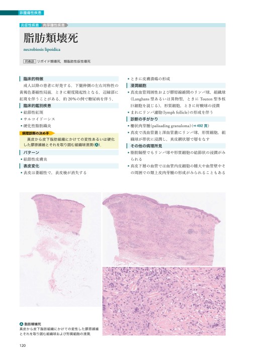 皮膚病理診断リファレンス | 書籍詳細 | 書籍 | 医学書院