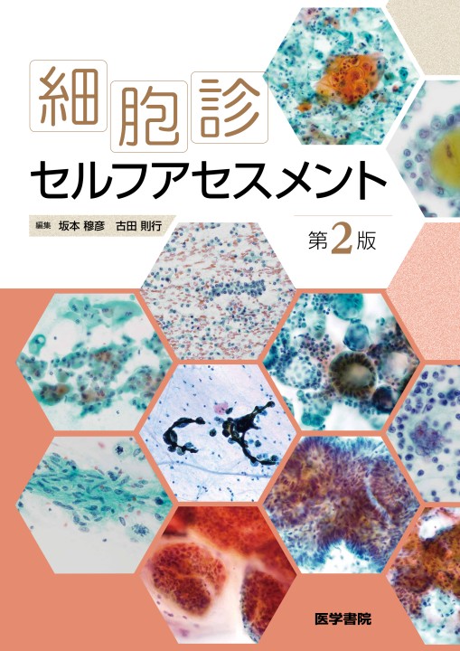 細胞診セルフアセスメント2e 立ち読み