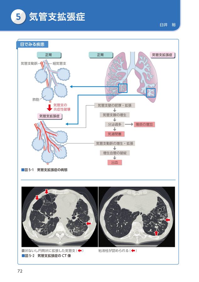 病期・病態・重症度からみた疾患別看護過程+病態関連図_第4版_立読み