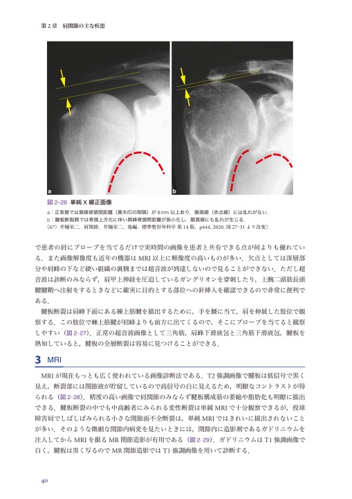 肩学 臨床の「なぜ」とその追究 Amazon.co.jp: 肩学-臨床の「なぜ」とその追究 : 井樋 栄二: 本