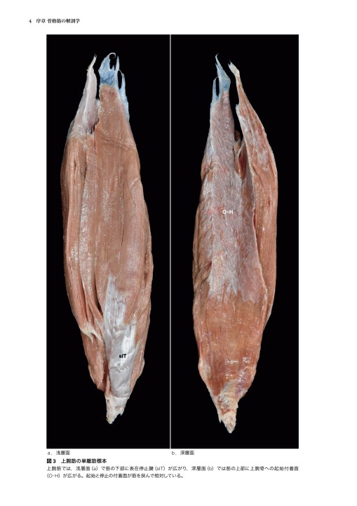 人体の骨格筋 上肢 第1版』 立ち読み