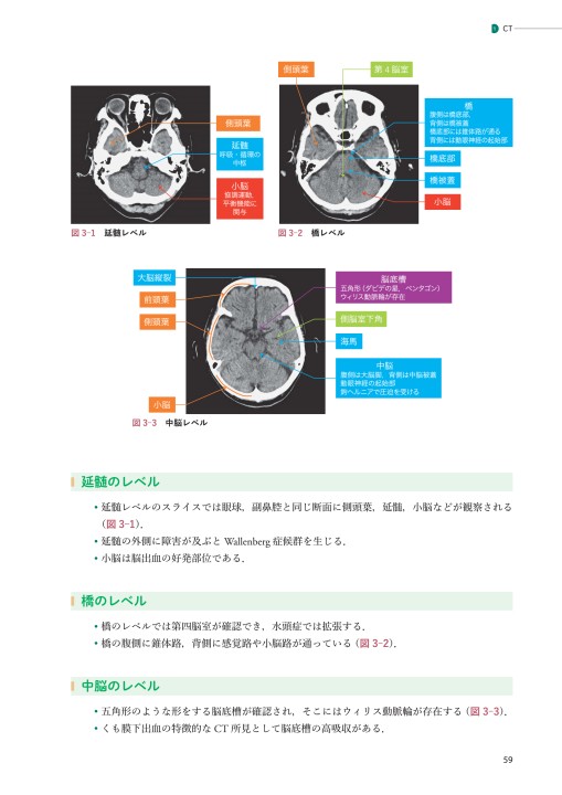 Amazon.co.jp: 脳血管障害のリハビリテーション医学・医療