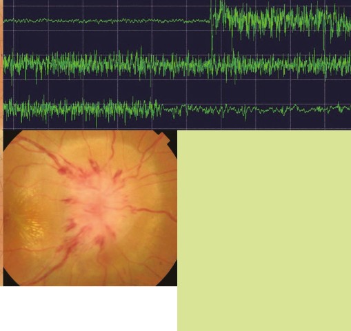 神経眼科学を学ぶ人のために_第3版』 立ち読み
