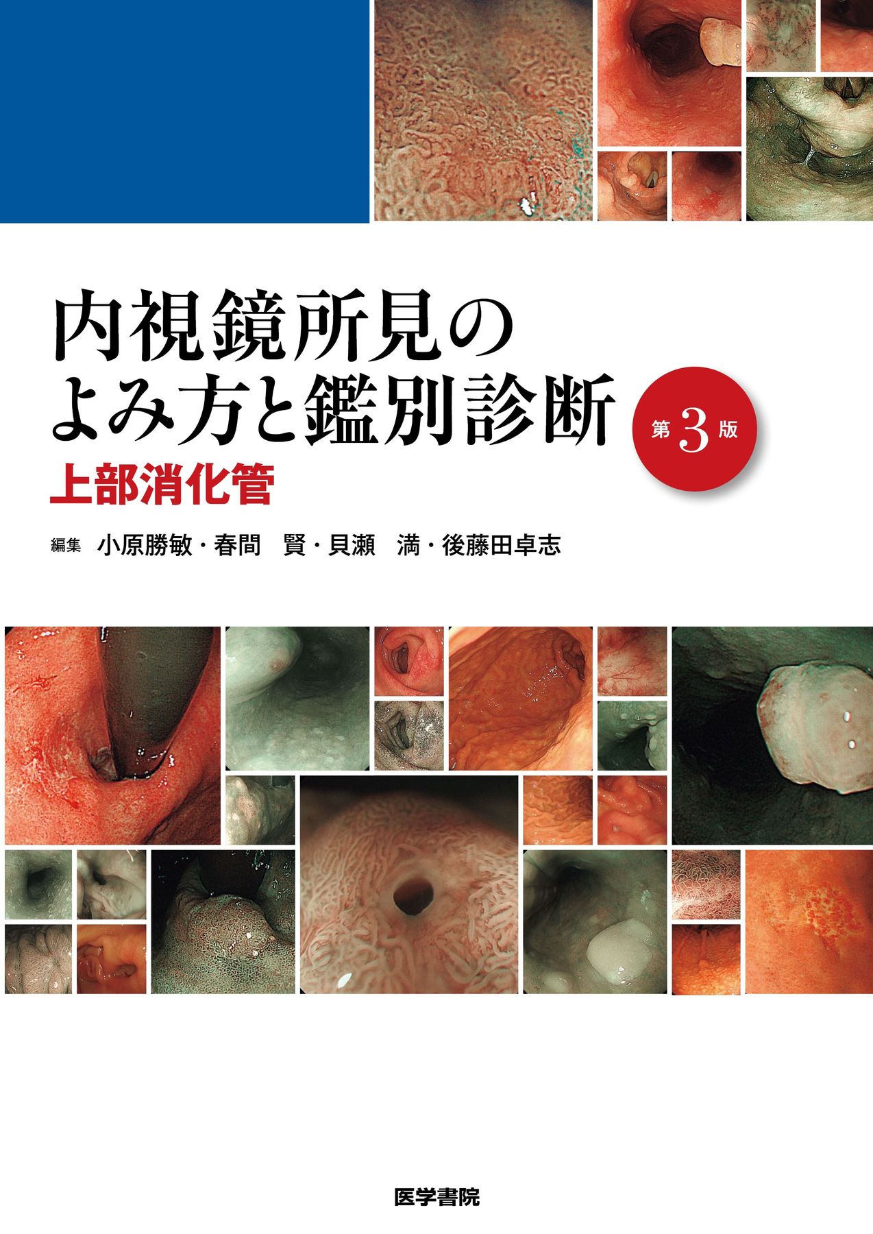 内視鏡所見のよみ方と鑑別診断_上部消化管_第3版_立読み