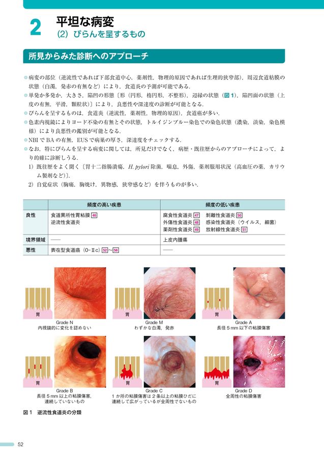 内視鏡所見のよみ方と鑑別診断_上部消化管_第3版_立読み