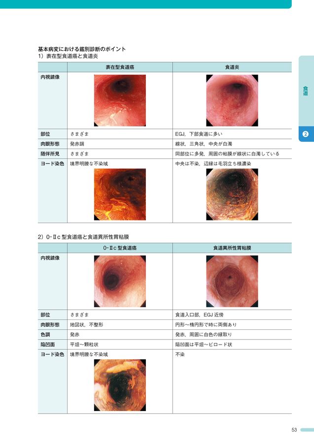 内視鏡所見のよみ方と鑑別診断_上部消化管_第3版_立読み