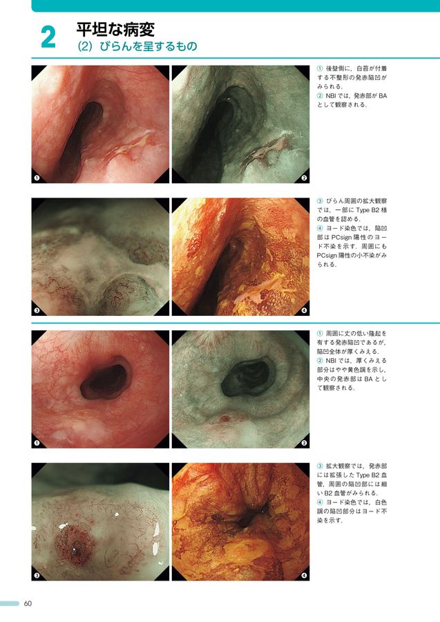 内視鏡所見のよみ方と鑑別診断 : 上部消化管 第3版 内視鏡所見のよみ方と鑑別診断―上部消化管 第3版 | 小原勝敏 春
