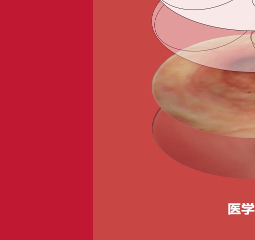 末梢病変を捉える 気管支鏡“枝読み”術 [DVD-ROM（Windows版）付] 第2版