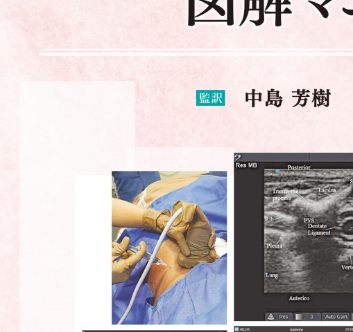 小児と成人のための超音波ガイド下区域麻酔図解マニュアル