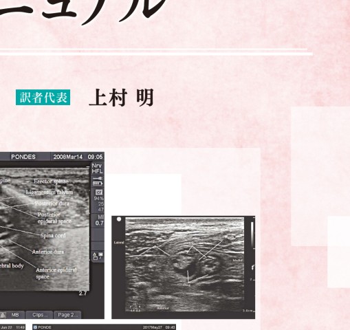 小児と成人のための超音波ガイド下区域麻酔図解マニュアル