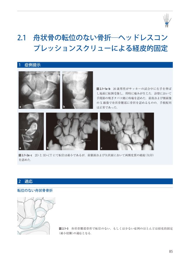 AO法骨折治療Wrist_立読み