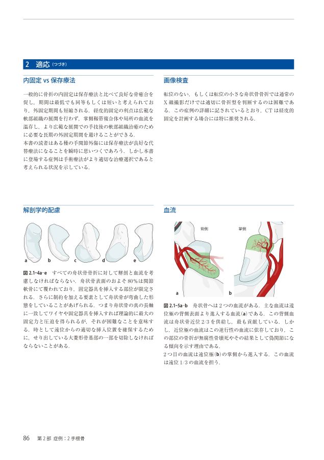 AO法骨折治療Wrist_立読み