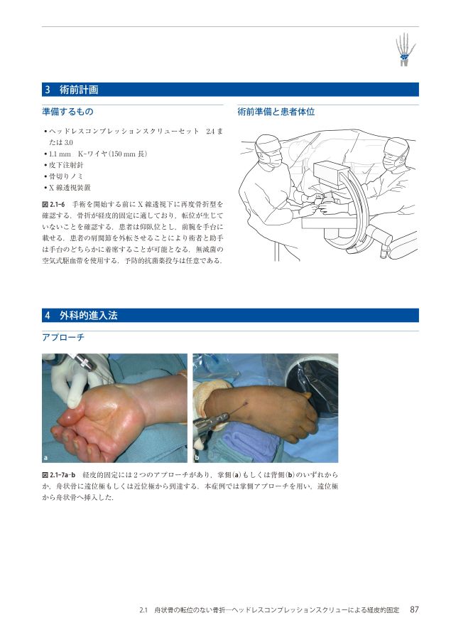 AO法骨折治療Wrist_立読み