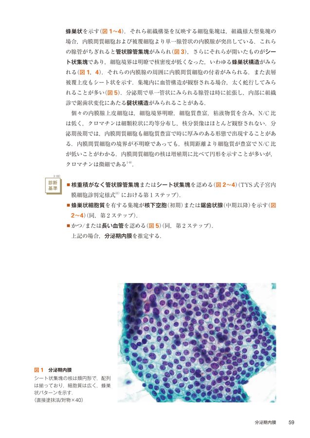 ヨコハマシステム準拠_子宮内膜細胞診アトラス_第2版_立読み