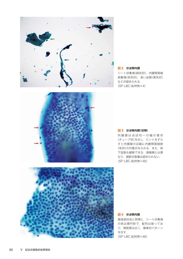 ヨコハマシステム準拠_子宮内膜細胞診アトラス_第2版_立読み