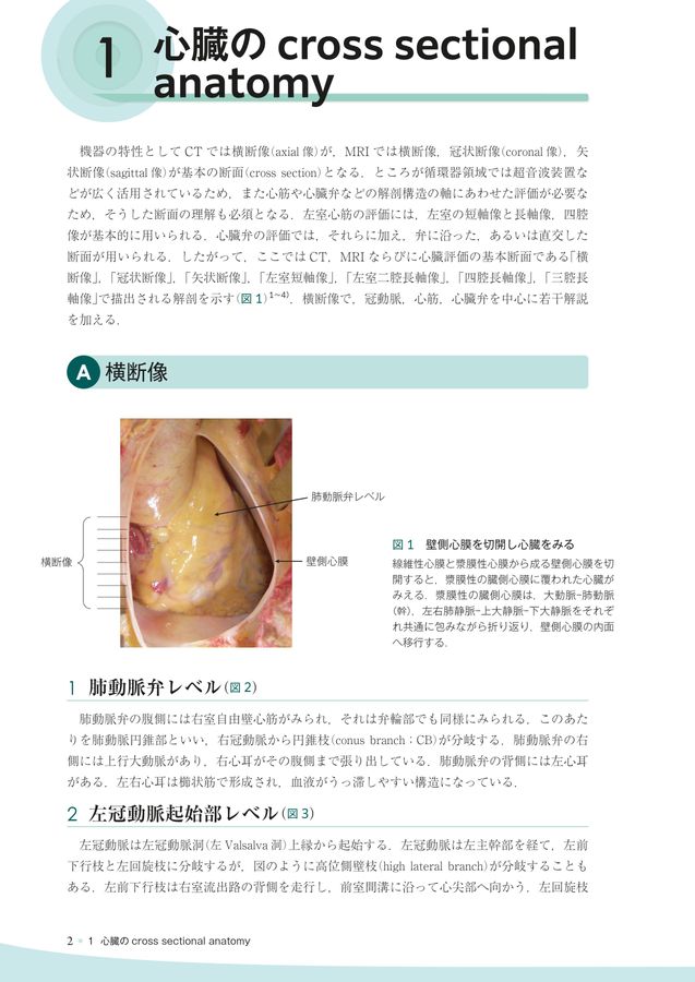 心臓疾患のCTとMRI 心臓疾患のCTとMRI 第2版 | 佐久間肇, 陣崎雅弘, 北川覚也, 石田