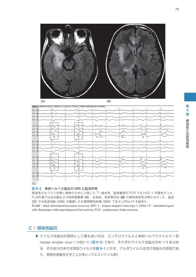 脳波で診る救命救急_意識障害を読み解くための脳波ガイドブック_立読み