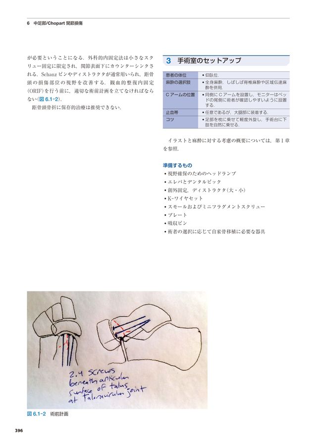 AO法骨折治療_Foot and Ankle_立読み