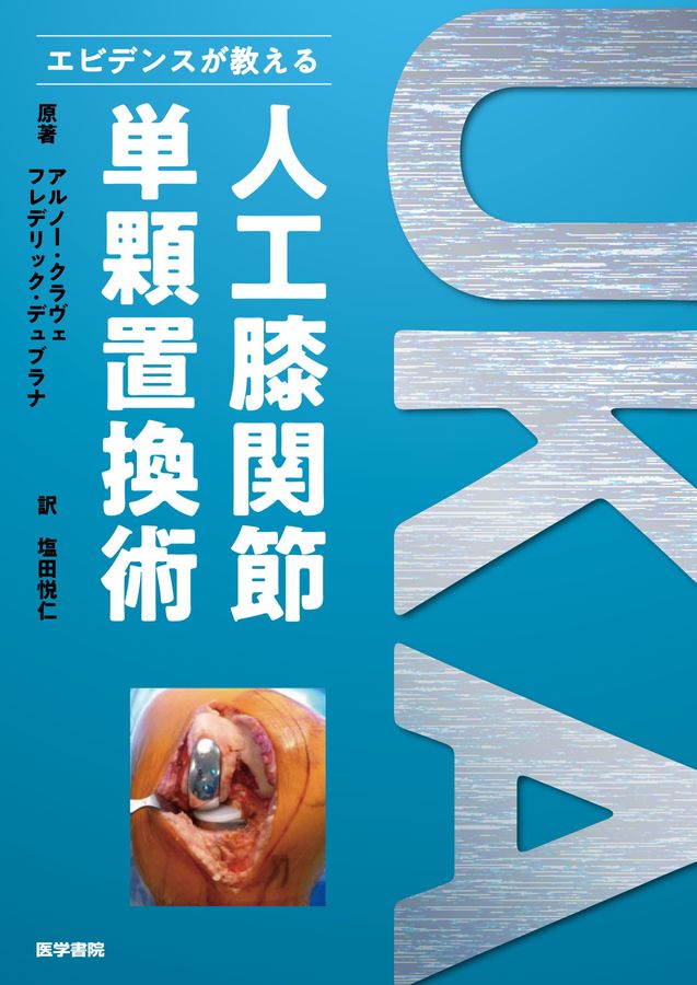 エビデンスが教える_人工膝関節単顆置換術_立読み
