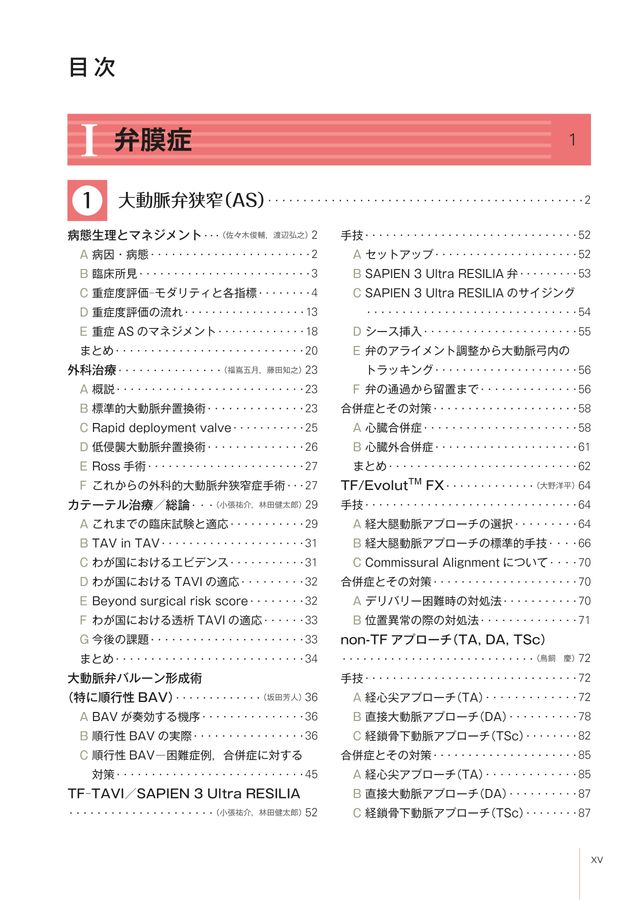 裁断済】SHDインターベンションコンプリートガイド