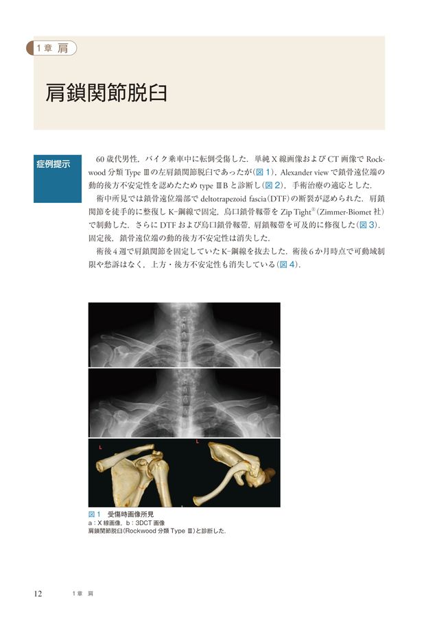 クリニカル・クエスチョンで考える外傷整形外科ケーススタディ_