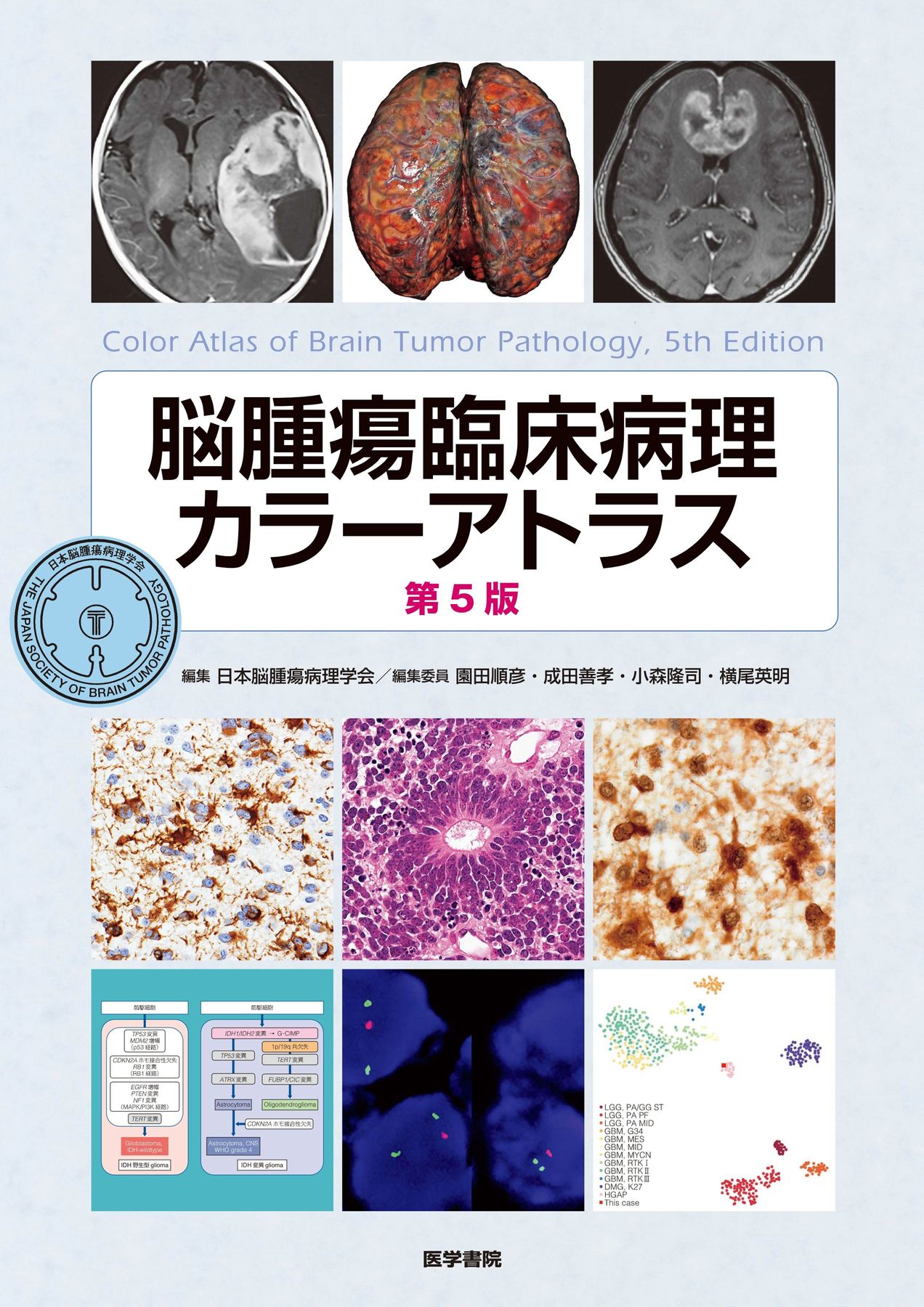 脳腫瘍臨床病理カラーアトラス 第5版