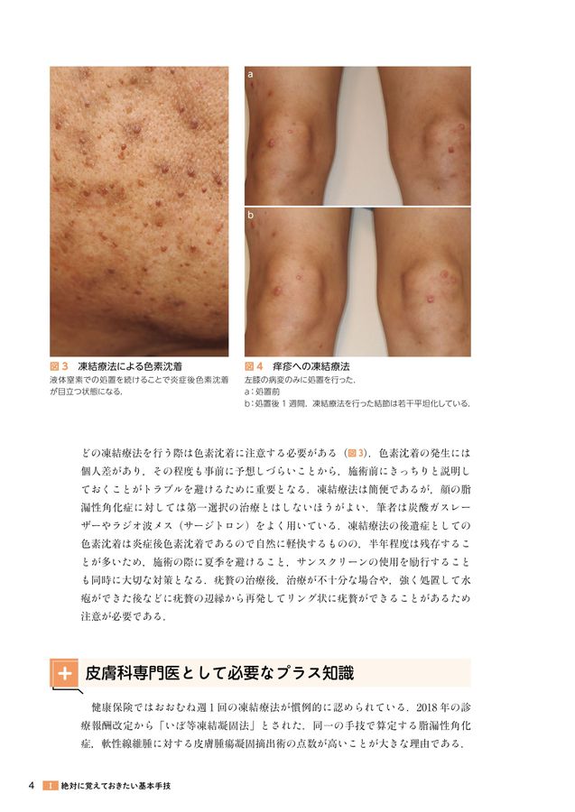 Amazon.co.jp: 皮膚科手技大全［Web動画付］ : 大塚篤司: 本