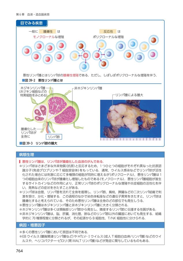 病期・病態・重症度からみた_疾患別看護過程＋病態関連図_第5版_立読み